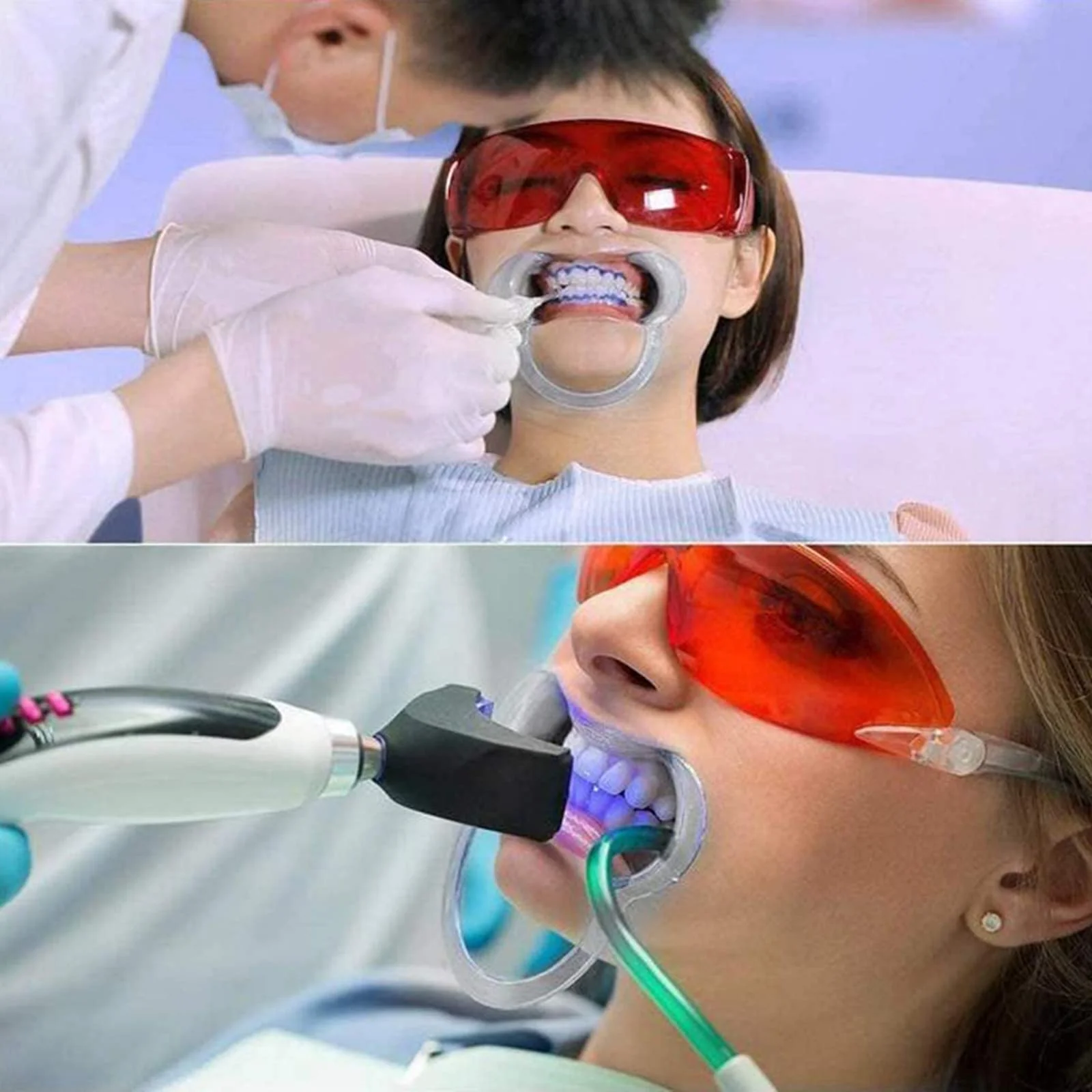 C-Shape Mouth Opener Mouth Lip Opener Mouth Separator Cheek Holder Intraoral Lips Mouth Opener C Shape Cheek Retractor Tools for Mouth Opener Challenge for Dental Care and Party Game Pack of 10 - Image 5