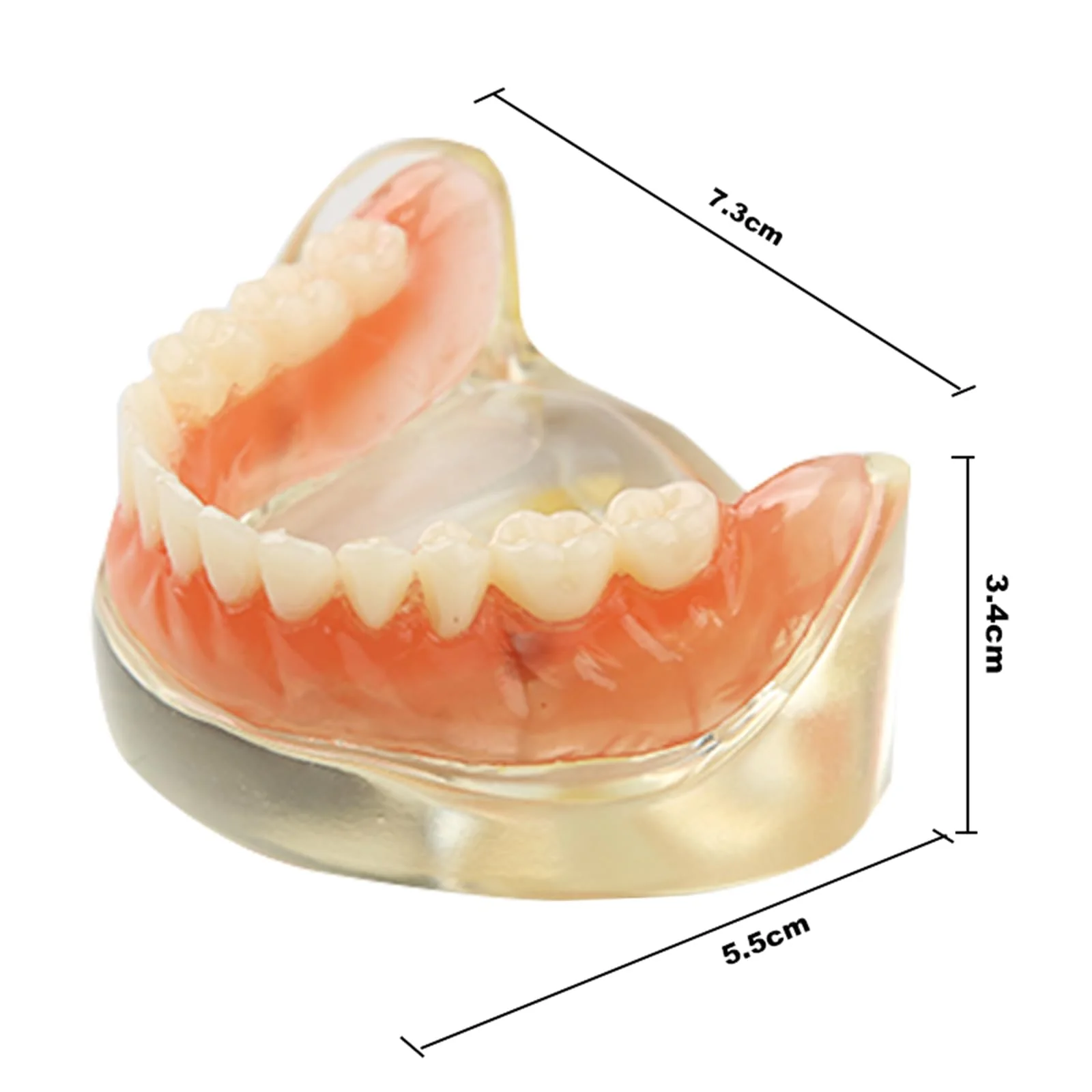 Dental Model Upper Jaw Deck Prosthesis with 2 Implants for Training and Study (Upper Jaw) - Image 2