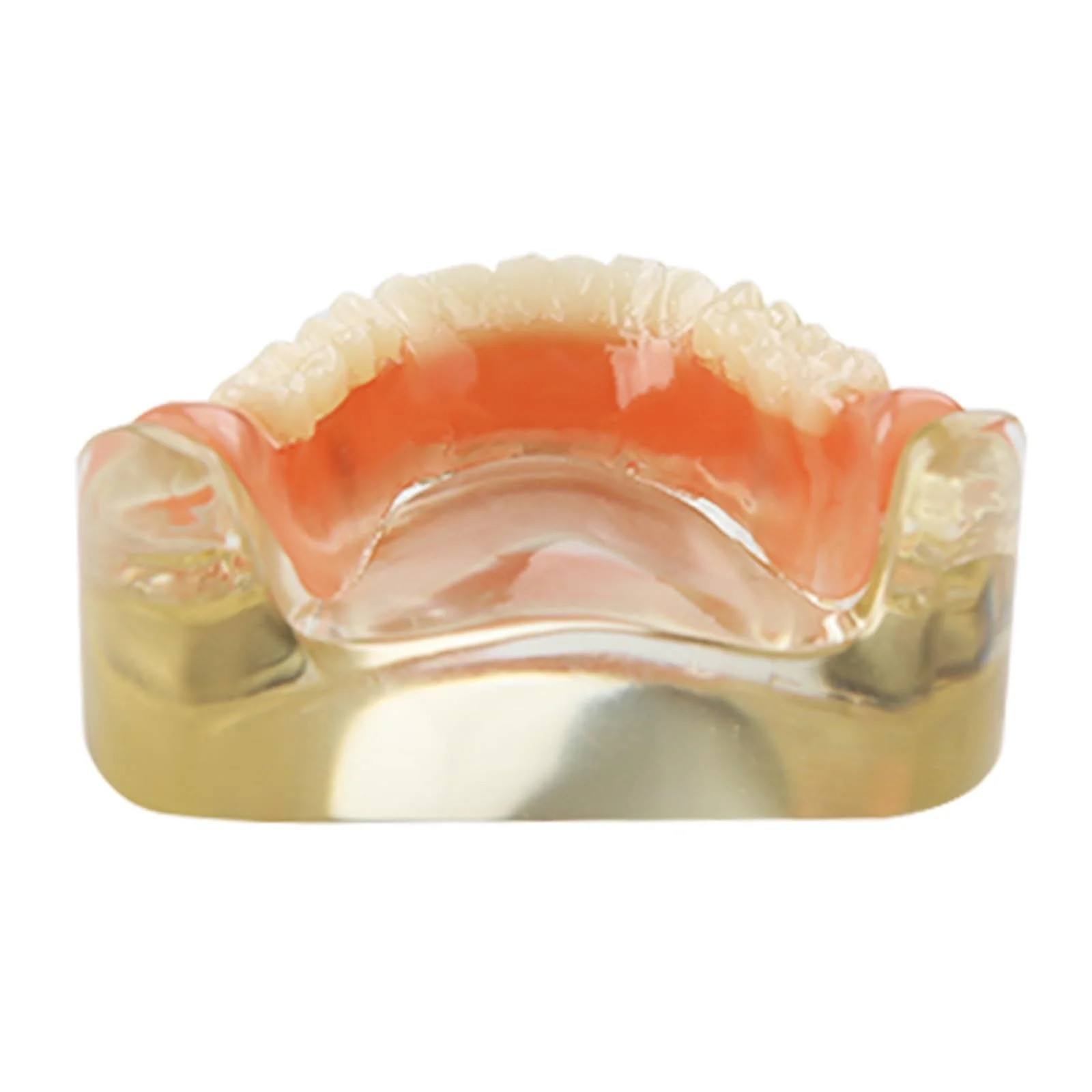 Dental Model Upper Jaw Deck Prosthesis with 2 Implants for Training and Study (Upper Jaw) - Image 5