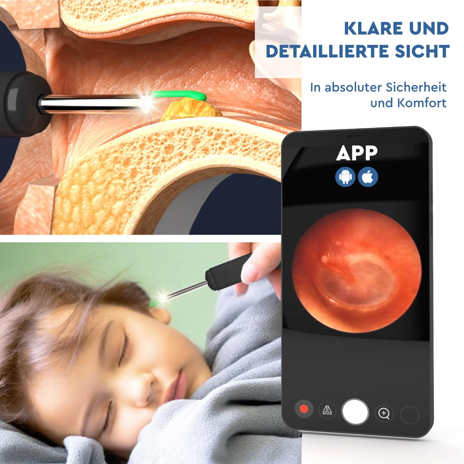 Ear Wax Remover Otoscope with Camera 1920p 3.6 mm WiFi Ear Cleaner - UdiGuard Ear Mirror Ear with 6 LED Lights Adults Rabbits and Children Black - Compatible with iPhone iPad Android Udiguard Black Otoscope - Image 3
