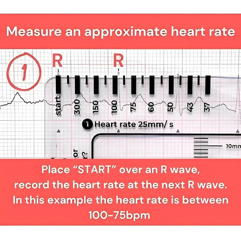 ECG 7 Step Ruler, ECG 7 Step Ruler for ECG/EKG Interpretation, ECG Ruler Plastic Ruler Measuring Tool, ECG Ruler Transparent, ECG Ruler Pocket etcard, Easy-to-Carry ECG Ruler (2 Pieces (with box)) - Image 3