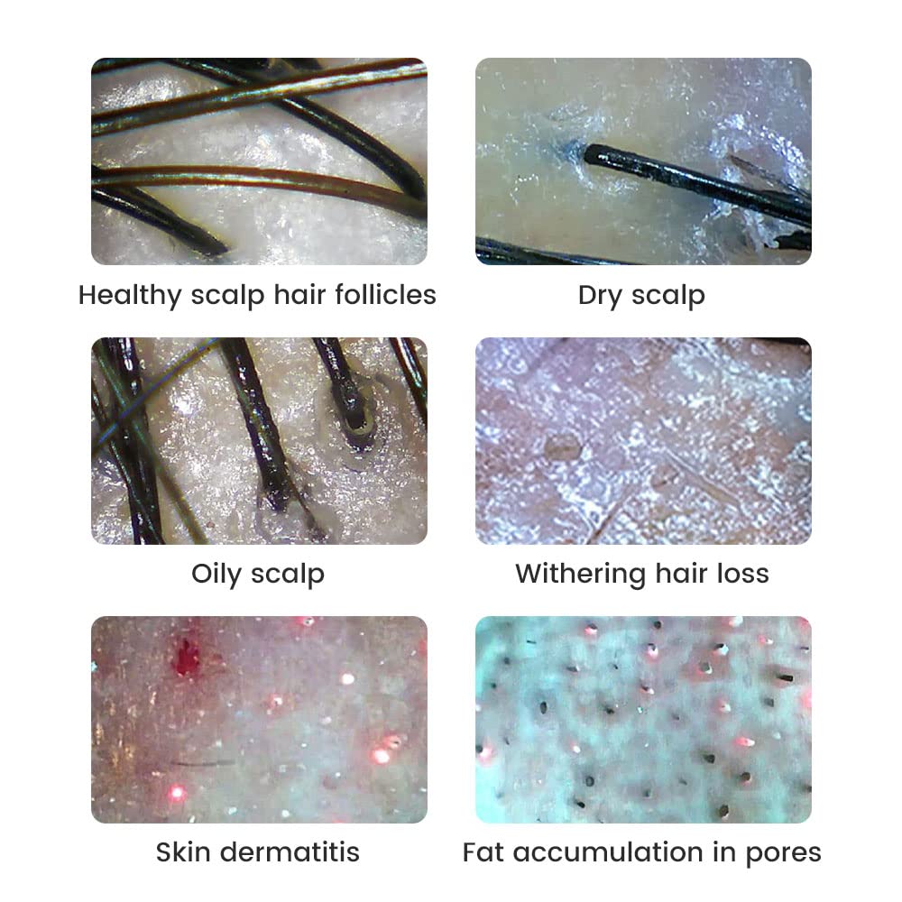 Handheld Dermatoscope Skin Analyzer Machine, Wireless Portable Digital Microscope with 1080P IPS Screen 8 LEDs, 500X Magnifier, for Scalp/Hair Trichomes Facial Skin Dermatoscope Black-Dual Mirror - Image 5