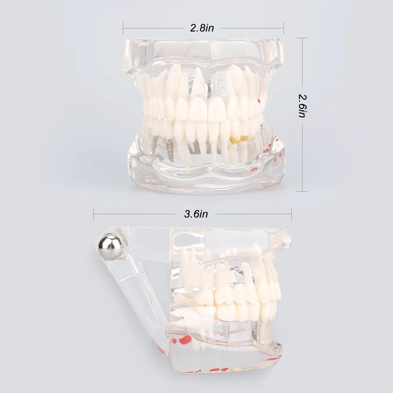 Model of Dentist Training, Dental Implant Disease Teaching Study Analysis Adult Typodont Demonstration Teeth Model New - Image 3