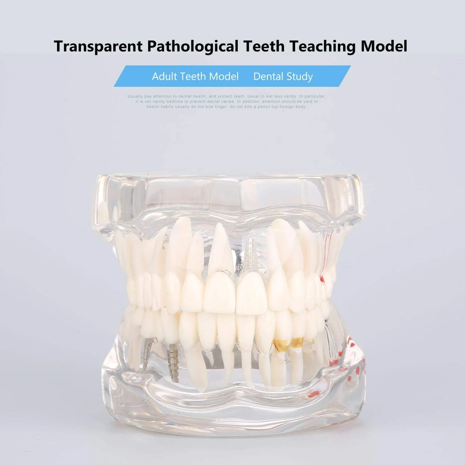 Model of Dentist Training, Dental Implant Disease Teaching Study Analysis Adult Typodont Demonstration Teeth Model New - Image 4