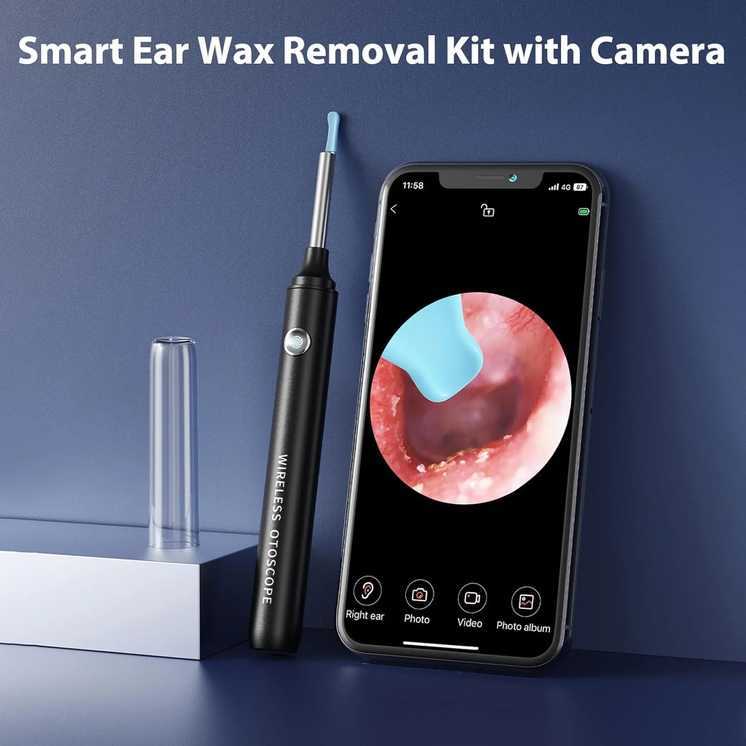 Qimic Ear Cleaner, Ear Wax Remover, 1080P Otoscope with Light, Ear Cleaner for Adults, Ear Wash, Ear Wash System, Ear Cleaning Set with 10 Ear Tips and Water Catching Basin blue-black - Image 3
