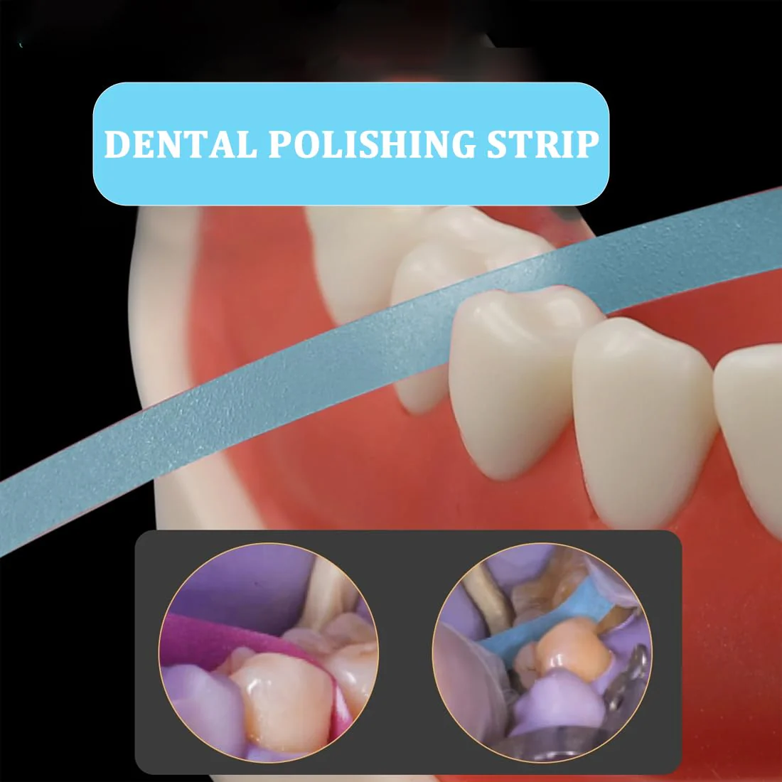 RDNKVB 1 x Dental Polishing Tool - Ultra-Fine 30μm Grit Size Strips for Interdental Grinding and Smoothing with 4 mm Width Resin Dental Polishing - Image 4