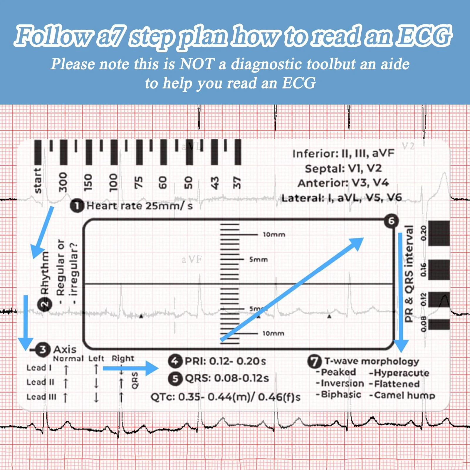 SNONESIY ECG 7 Step Ruler, Transparent ECG Calipers Meter, Plastic, 9 x 6.5 cm - Image 7